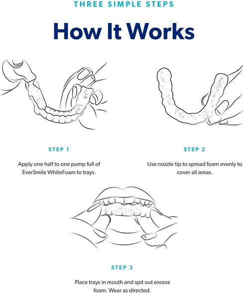 EverSmile AlignerFresh Extra Whitening Aligner & Retainer Cleaning Foam. AlignerFresh Cleaning Foam for Invisalign, ClearCorrect, Essix, Hawley Tr...