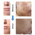 2% BHA Liquid Salicylic Acid Exfoliant | Skin Perfecting Salicylic Acid Liquid Exfoliant Serum | Facial Exfoliant for Blackheads, Enlarged Pores, ...