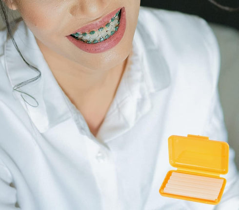 15 Pack Blue Braces Wax Dental Care Orthodontic Wax for Braces Wearer...