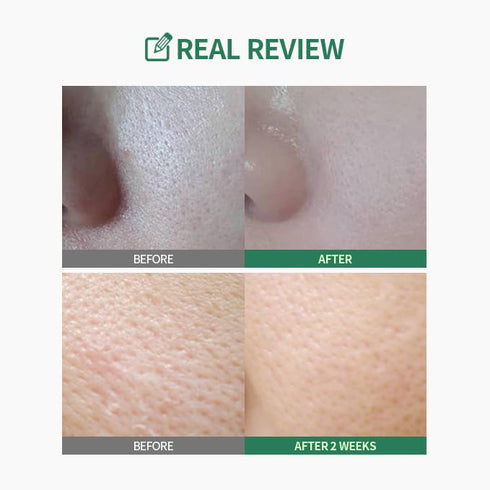 Green Tomato Double Cleansing Ampoule Oil 200g | Daily Makeup Blackhead Melting | Double Cleansing | for Women Korean Skin care...