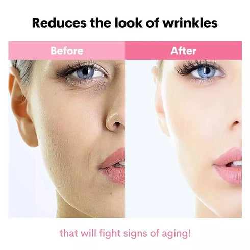 Advanced Snail Mucin 96% Power Repairing Essence 3.38 fl.oz 100ml, Hydrating Serum for Face with Snail Secretion Filtrate for Dull Skin & Fine Lin...