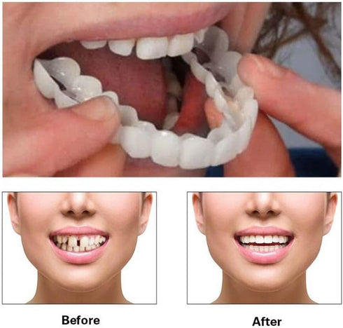 2 Pairs, Adjustable,Confident Smile for Men and Women(White)...