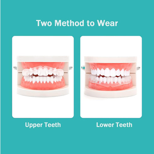 20pcs Night Guard Teeth Grinding Anti Grinding Teeth Protectors Mouth Sleeping Dental Pads Mouth Guard Oral Protection Bite Guards, Anti-Grinding ...