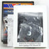 Walker Products 15789C Carburetor Kit...