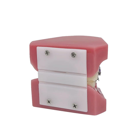 TM-208 Demonstration Orthodontic Model Teeth Teach Study Tools with Metal and Ceramic Bracket(Red)...