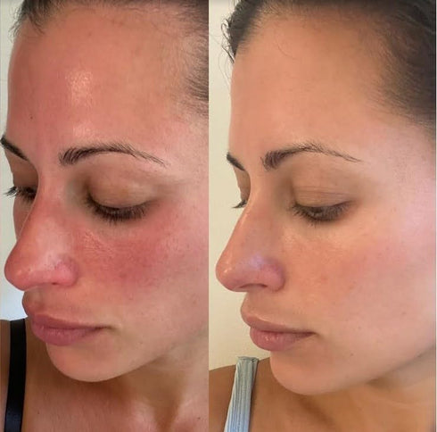 Single Pack - After Sun Skin Care - Supports Healthy Skin from the Inside Out -Promotes Hydration - Sun Damage Support - Mix with Water - Travel S...