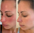 Single Pack - After Sun Skin Care - Supports Healthy Skin from the Inside Out -Promotes Hydration - Sun Damage Support - Mix with Water - Travel S...