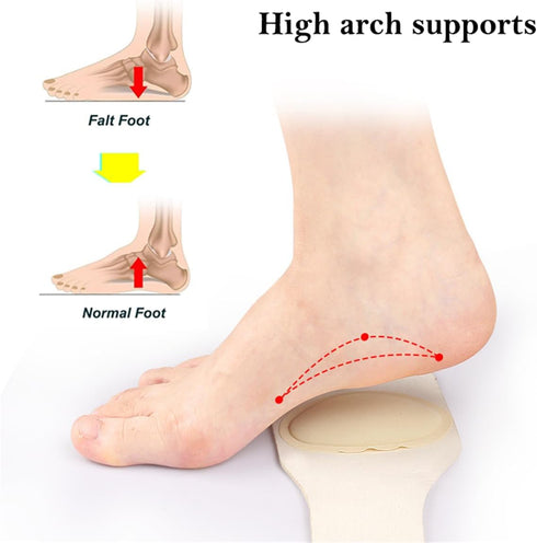 Arch Support Sleeves - Upgrade Adjustable Orthotic Wrap Compression Arch Support Brace with Gel Pad for Flat Feet & Plantar Fasciitis Pain Relief ...