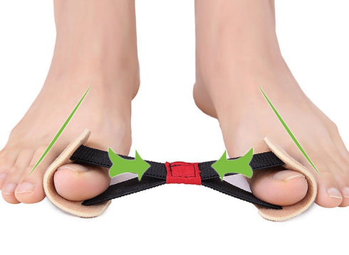 Big Toe Strap Bunion Straightener Stretchy Belt Toe Stretcher Alignment Hallux Valgus Corrector Foot Pain Relief...
