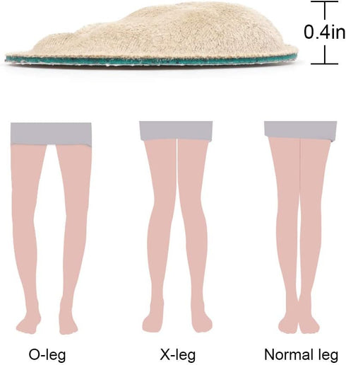 Dr. Foot's Supination & Over-Pronation Corrective Shoe Inserts, Medial & Lateral Heel Wedge Insoles for Foot Alignment, Knee Pain, Bow Legs, Osteo...