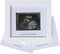 IHEIPYE Baby Sonogram Photo Frame - Ultrasound Picture Frame for Expecting Parents, Baby Showers, Gender Reveal Parties, Nursery Decor (Silver Tex...