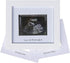 IHEIPYE Baby Sonogram Photo Frame - Ultrasound Picture Frame for Expecting Parents, Baby Showers, Gender Reveal Parties, Nursery Decor (Silver Tex...