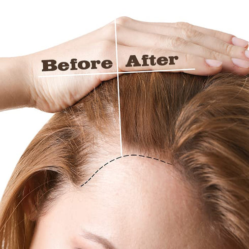 Super Gro Hair Oil | Jamaican Black Castor Oil + Jojoba Oil | Double Strength Hair Growth, Renewing strength, and moisture | 100% Natural Oil Wil+...