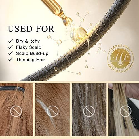 Prewash Dry Scalp Hair Oil Treatment - Pre Shampoo Rosemary Hair Oil for Dandruff Itchy Scalp, 1 Pack 1.7 fl oz...