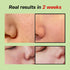 Green Tomato Pore Lifting Ampoule + | Instant Pore Minimizing & Tightening Facial Serum for Enlarged and Saggy Pores | Korean Skincare | 1.01 Fl O...