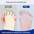 Carolhome Toe Separators 4pcs Gel Toe Splints Protectors Toe Spacers Toe Bunion Corrector Straighteners for Pain Relief Overlapping Hammer Toes, C...