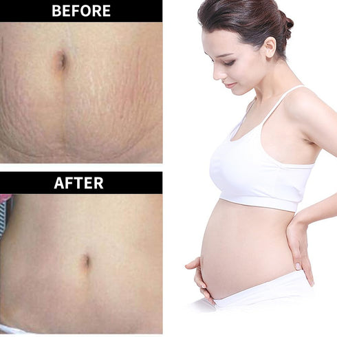 VGO Skincare Body Oil Moisturizing Oil Vitamin A E Serum for Scars Skin, Face & Full Body, Promotes Healthy-Looking Skin 50ml / 1.69oz...