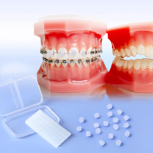 JMU Orthodontic Wax for Braces 10 Pack, Precut 500 Braces Wax Dots, Dental Wax Unscented...