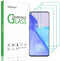 beukei (3 Pack) Compatible for OnePlus 9 / OnePlus 9 5G Screen Protector Tempered Glass,Touch Sensitive,Case Friendly, 9H Hardness...