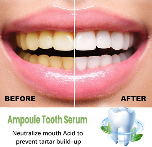 20Pcs Tlopa Ampoule Tooth Serum, Ampoule Essence Toothpaste, Teeth Toothpaste Serum, Solve All Oral Problems....