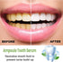 20Pcs Tlopa Ampoule Tooth Serum, Ampoule Essence Toothpaste, Teeth Toothpaste Serum, Solve All Oral Problems....