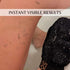 Exfoliating Glove Kessa Mitt Body Scrubber - Dead Skin Remover Shower Glove for Dead Skin Scrubbing and Deep Pore Cleansing - by MoroccanSource (1...