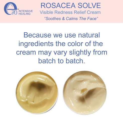 Rosacea Solve - Redness Relief Cream - Face Moisturizer For Rosacea & Acne Prone Skin - Sensitive Skin Care With Organic Ingredients, Almond Oil, ...