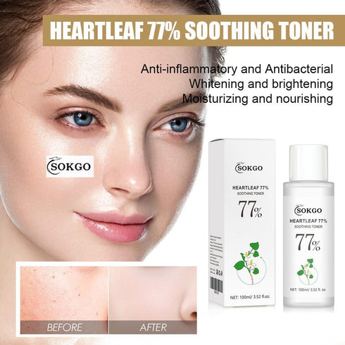 Heartleaf 77% Soothing Toner with HOUTTUYNIA CORDATA Extract for Deep Moisture Balance and Soothing, Facial Care for Sensitive Dry Oily Skin...