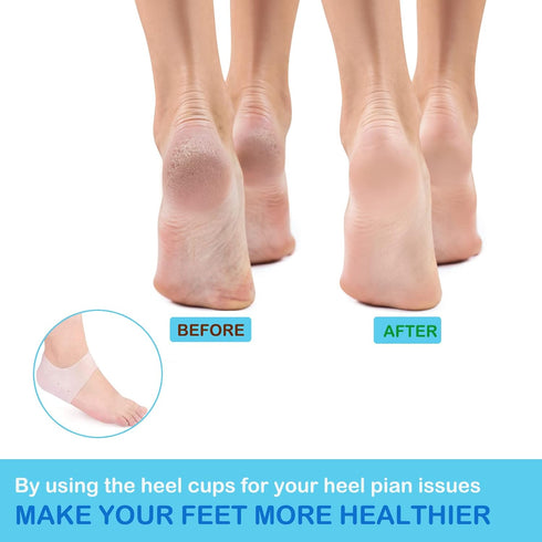 Wonderwin Gel Heel Cups,Breathable Heel Protectors for Cracked Heels, Heel Spurs, Plantar Fasciitis,Medical-Grade Heel Cups for Men & Women's Heel...
