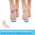 Wonderwin Gel Heel Cups,Breathable Heel Protectors for Cracked Heels, Heel Spurs, Plantar Fasciitis,Medical-Grade Heel Cups for Men & Women's Heel...