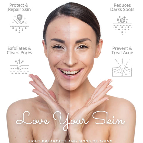 2% Salicylic Acid Serum - Exfoliating acne skin care - Promotes Smooth, Bright Skin - Vegan Friendly & Cruelty Free | 30ml...