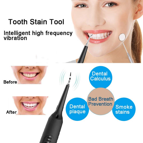 Electric Dental Calculus Remover, Household Tartar Scraper Tartar Remove for Fighting Tartar Tooth Stains Teeth Polishing, 4 Replaceable Heads, Po...