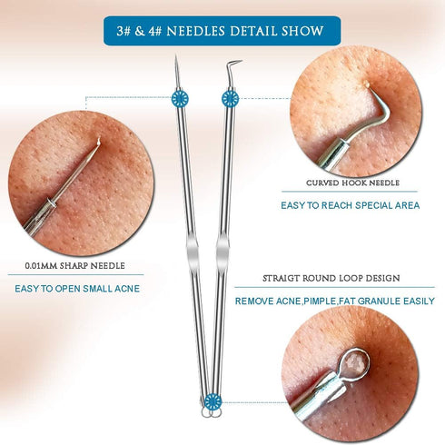 6PCS Dual Heads Blackhead Remover, Pimple Comedone Extractor, Acne Whitehead Blemish Removal Kit, Premium Stainless Steel, Risk Free for Face Skin...