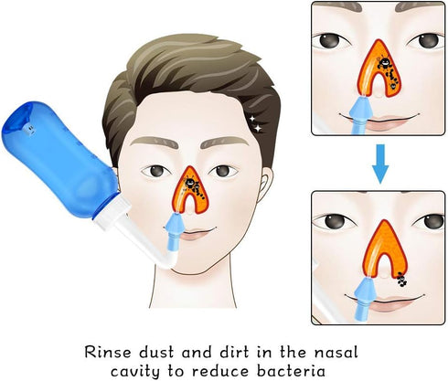 Darate Neti Pot Sinus Rinse Bottle, Nose Wash Cleaner Pressure Rinse Nasal Irrigation for Adult & Kid BPA Free with Sticker Thermometer (500ML)...