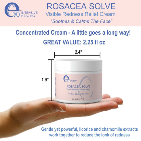 Rosacea Solve - Redness Relief Cream - Face Moisturizer For Rosacea & Acne Prone Skin - Sensitive Skin Care With Organic Ingredients, Almond Oil, ...