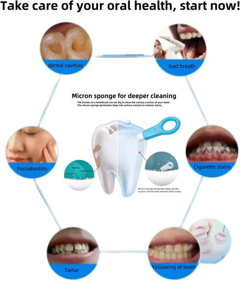 Nano Physical Teeth Cleaning Stick, Teeth Whitening, Cleaning Teeth Smoke Stains, Tartar Stains, Home Oral Care Whitening Teeth Kit, 1+10 Pcs (wit...