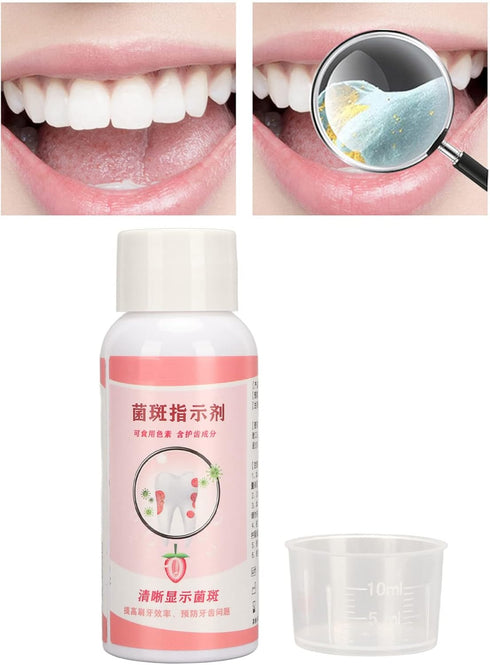 Plaque Disclosing Agent, 60ml Dental Plaque Indicator with Scale Cup, Oral Tartar Test Examination for Kids or Adults Teeth, Plaque Identifying, C...