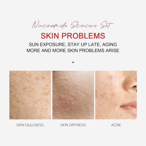 Niacinamide Travel Size Skin Care Set, Travel Size Skincare Set for Teenagers Girls, Travel Size Face Care Kit with Cleanser, Eye Cream, Cream, Fa...