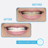 GO SMILE On The Go Teeth Whitening Pen, Teeth Whitener & Stain Remover Self Care Gifts for Women & Men - Whitening Strips Alternative - Travel Siz...