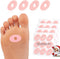 Corn Cushions, Self-Stick Callus Cushions, Corn Pads for Toes, Feet, Bottom of Foot, Heel | Protect Calluses and Reduce Friction - Oval Shape, 10 ...