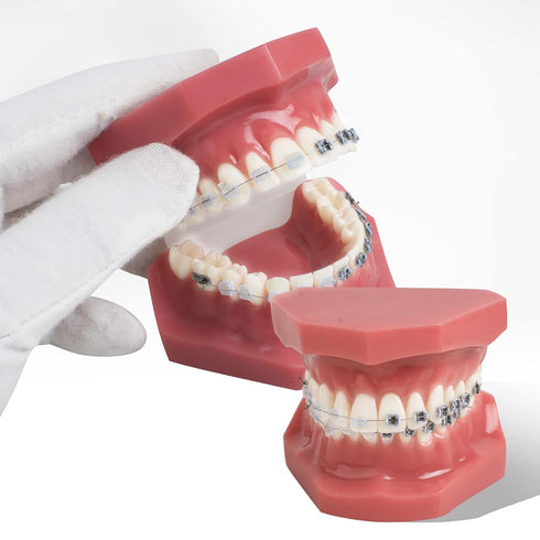 TM-208 Demonstration Orthodontic Model Teeth Teach Study Tools with Metal and Ceramic Bracket(Red)...