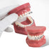 TM-208 Demonstration Orthodontic Model Teeth Teach Study Tools with Metal and Ceramic Bracket(Red)...