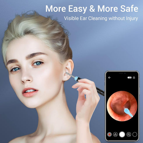Ear Wax Removal, Ear Cleaner Camera with 1296HD, Ear Wax Removal Kit with 8 Pcs Ear Cleaning Tools, Ear Camera with 6 LED Lights, Ear Cleaner for ...