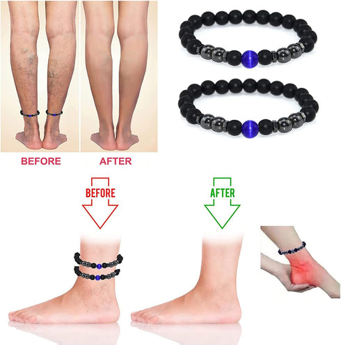 Anti-Swelling Black Obsidian Anklet, 2pcs Black Obsidian Anklet Swelling,Obsidian Beaded Bracelet For Men/Women Gifts...