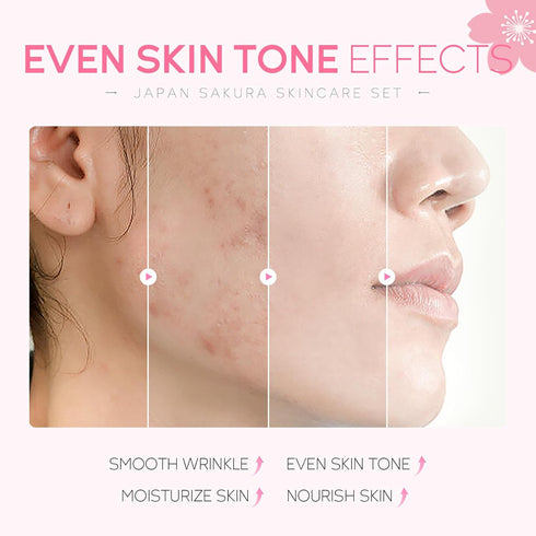 Skin Care Set JAPAN SAKURA Women Beauty Gift Sets Skin Care Kit with Cleanser, Toner, Serum, Eye Cream, Face Cream Travel Kit for Women Teen Girls...