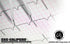 EMI Basix EKG Caliper and EKG Ruler Combination Set EKR-203...
