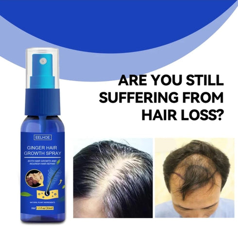 Ginger Hair Growth Spray. Promotes Thicker Longer Hair. Ginger Extract Prevents Baldness, and Moisturizes the Scalp. Promotes Hair regrowth, stren...