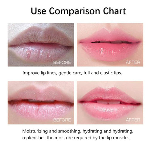 20Pcs Moisturizing/Plumping Lip Mask, Restores Moisture Mask for Dry Lips and Lines Overnight Care, Gel Treatment Masks (Pink)...