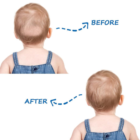 Bassinet Sheets for Baby Boy Girl, Satin Bedside Sleeper Sheets to Fit Mika Micky&Baby Delight&Dream On Me&Baby Joy Bassinet, Bassinet Sheet for B...