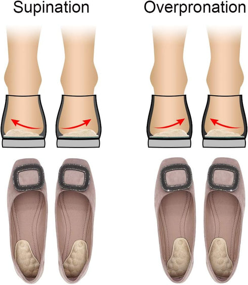 Dr. Foot's Supination & Over-Pronation Corrective Shoe Inserts, Medial & Lateral Heel Wedge Insoles for Foot Alignment, Knee Pain, Bow Legs, Osteo...